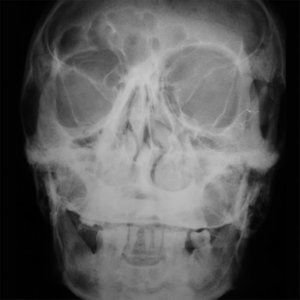 Khola Cosmica - Khola Cosmica 1LP