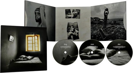 Suede - Dog Man Star 3CD