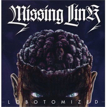 Missing Link - Lobotomized 1CD